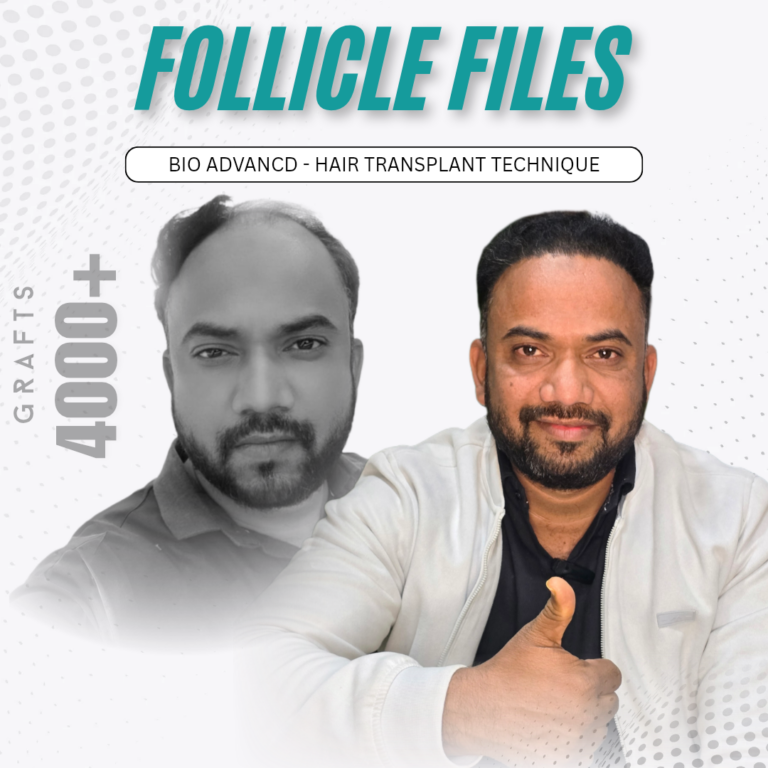 Healthy Extracted Follicular Unit Grafts