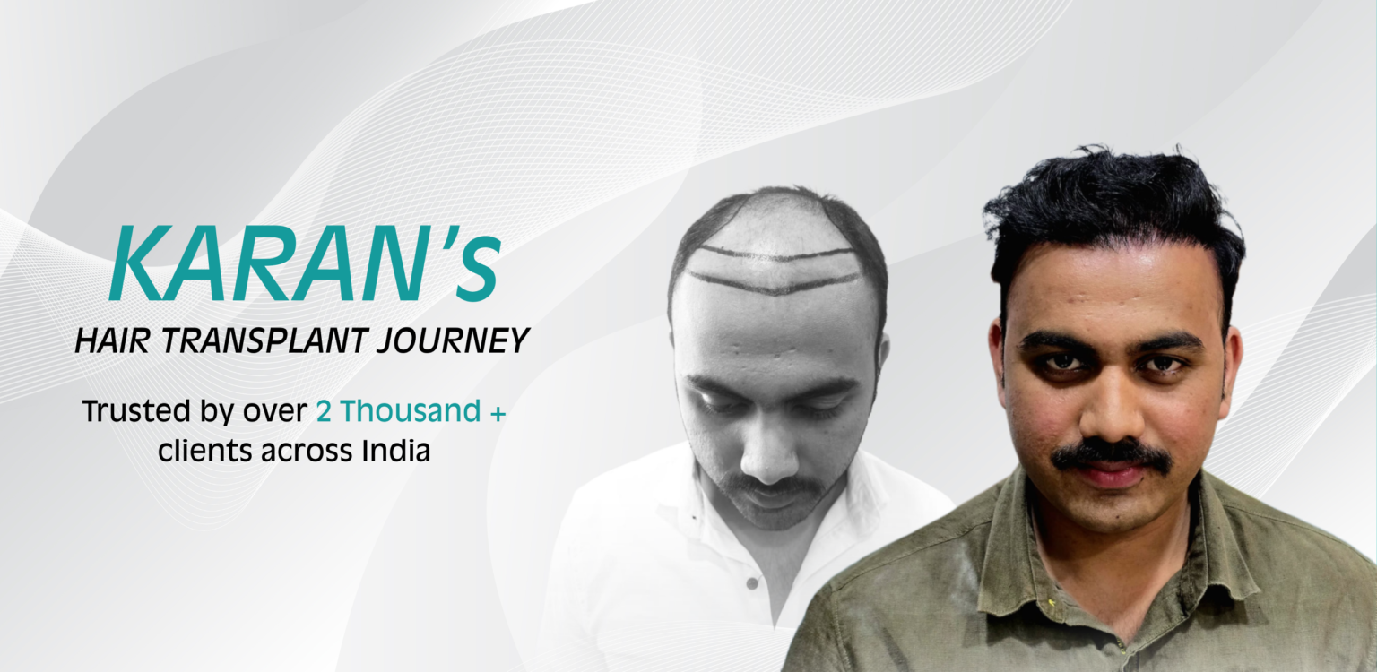 Alive Hair Clinic Banner 2