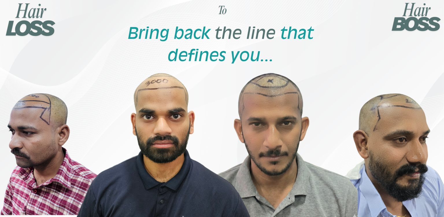 Alive Hair Clinic Banner 3